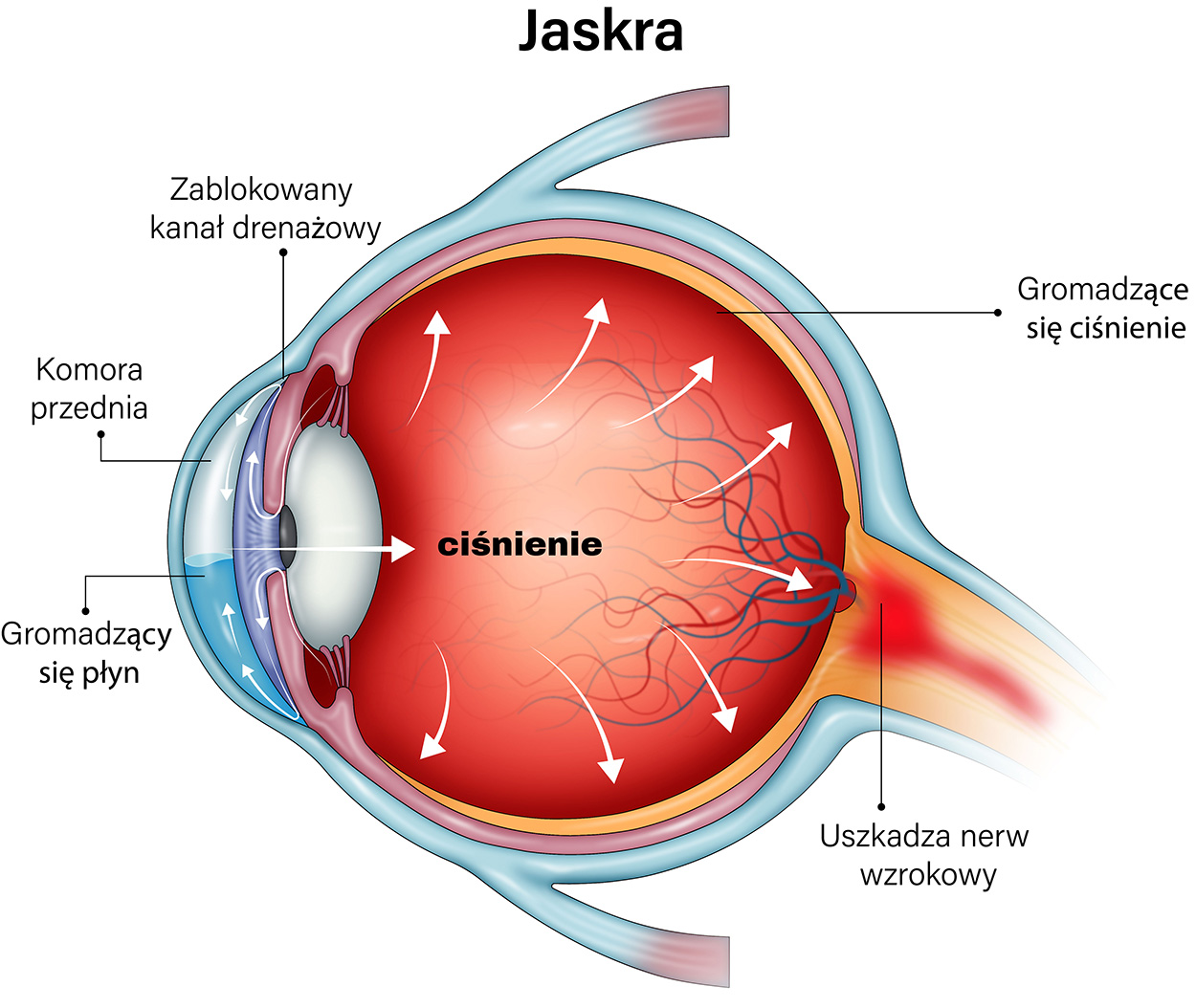 zdrowe oko i retinopatia cukrzycowa